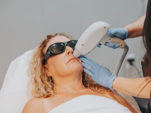 Laser Hair Removal on the Upper Lip