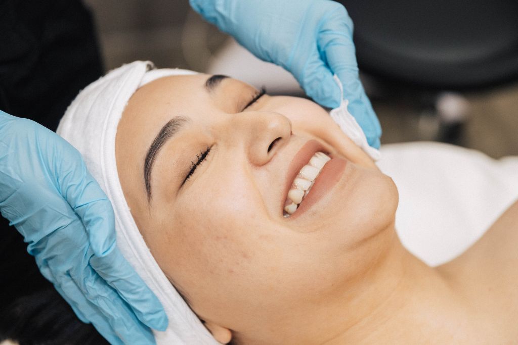 Chemical Peel Treatment