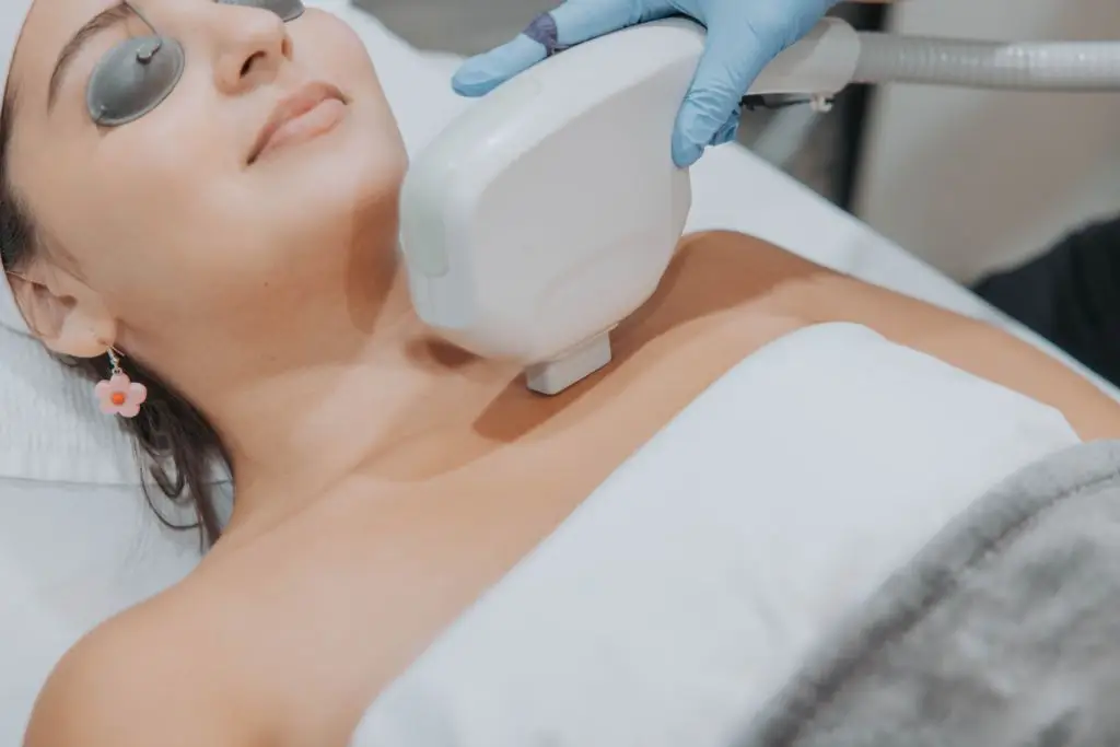 Photofacial on the Chest