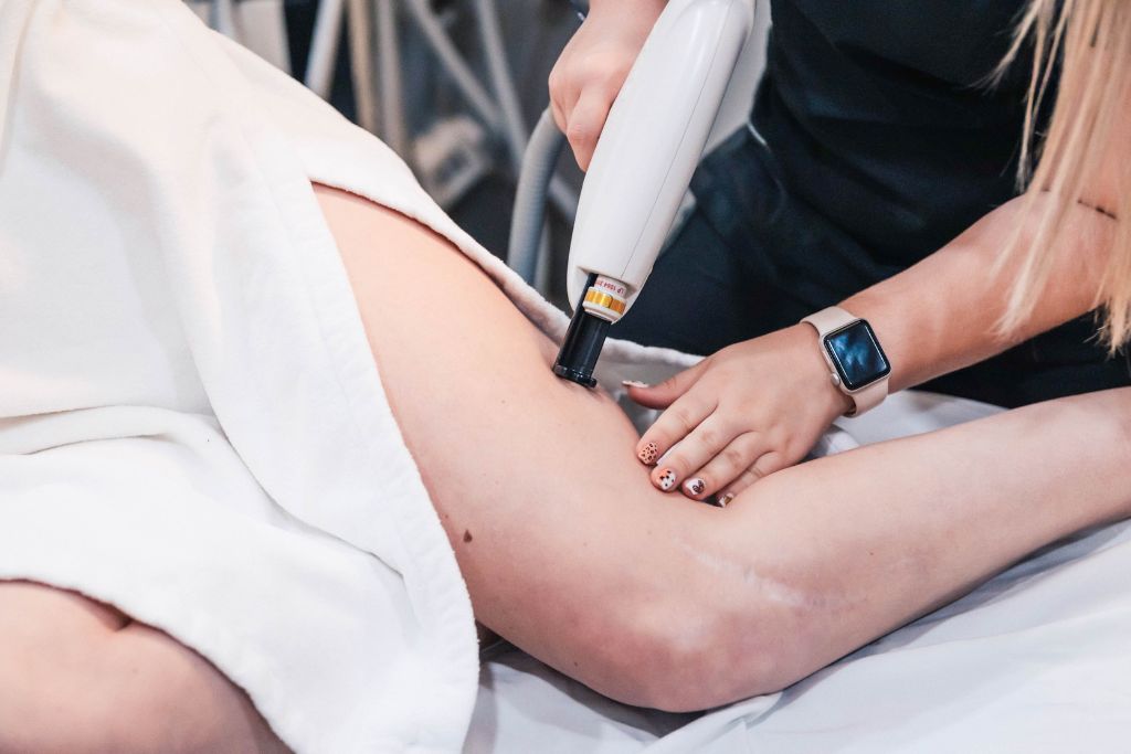 Laser Vein Removal