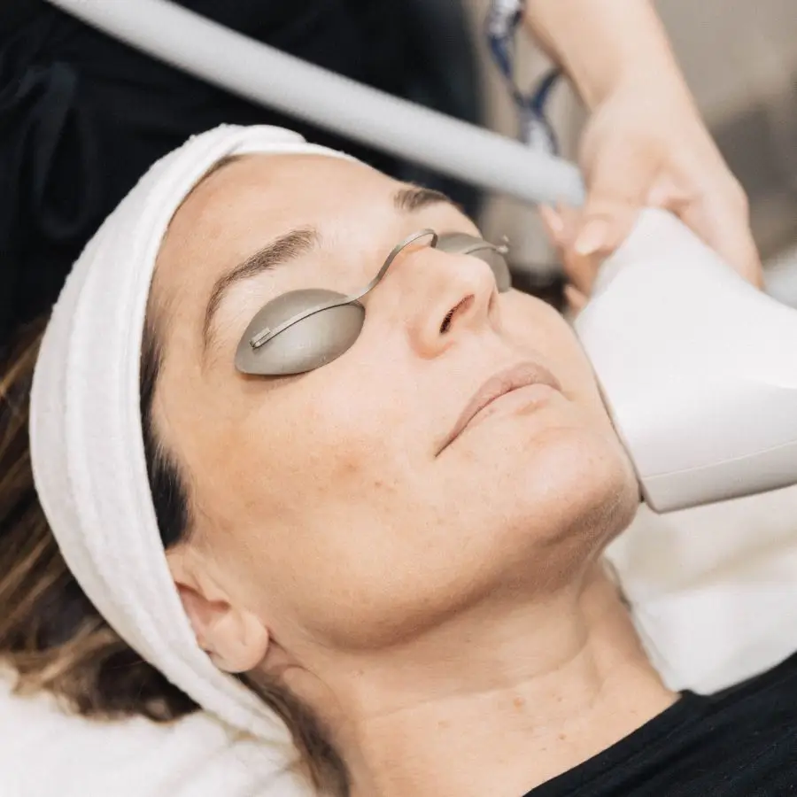 Laser Skin Tightening