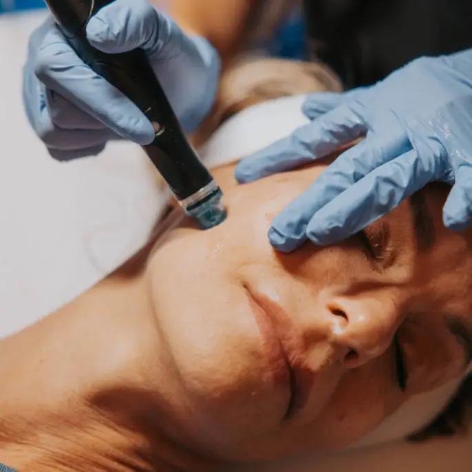 HydraFacial Treatment