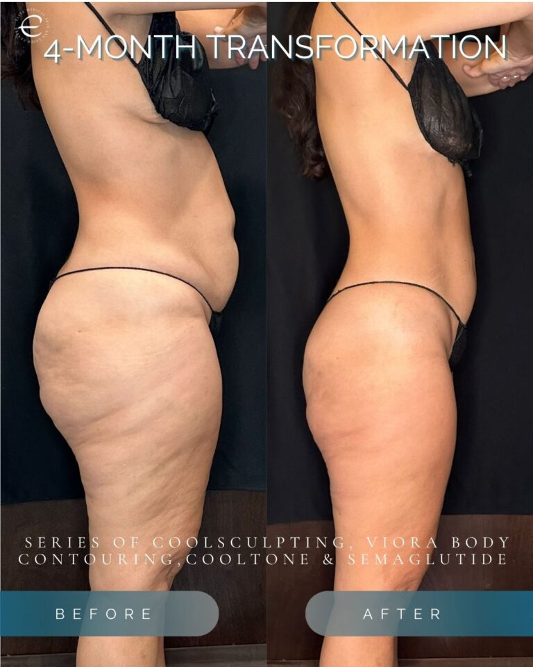 Instagram Posts (81)