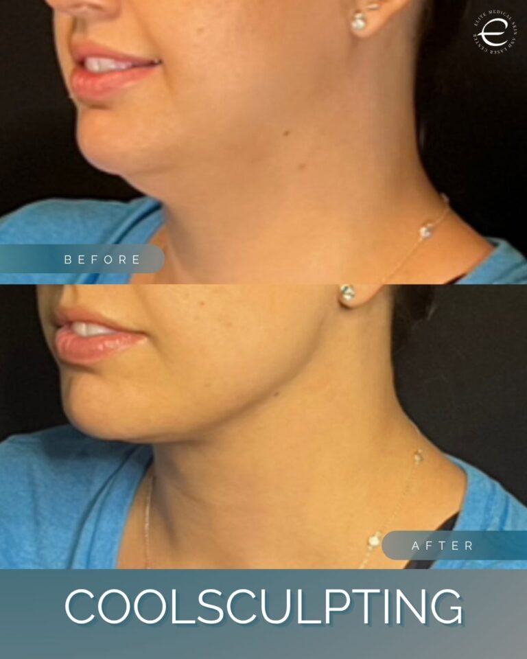 Instagram Posts (82)