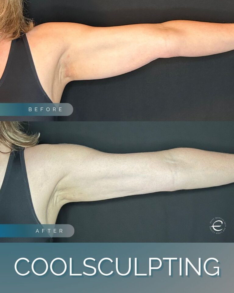 Instagram Posts (83)