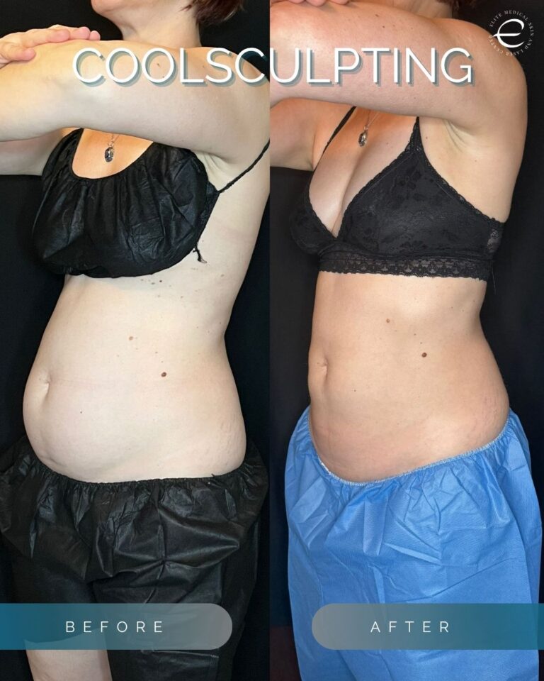 Instagram Posts (84)