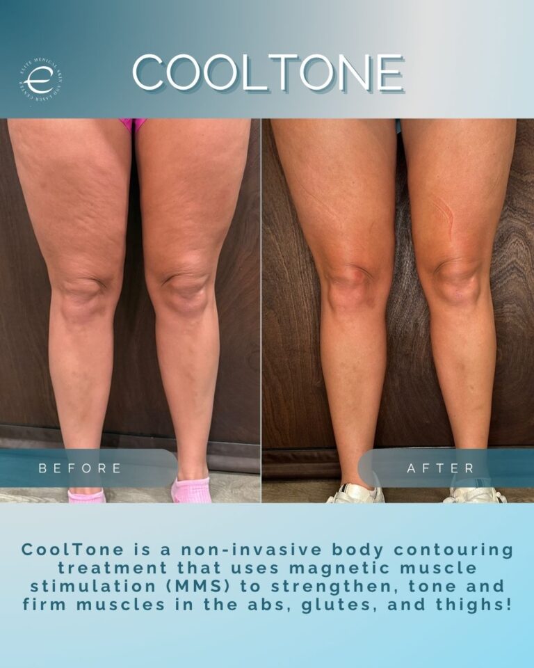 Instagram Posts (85)